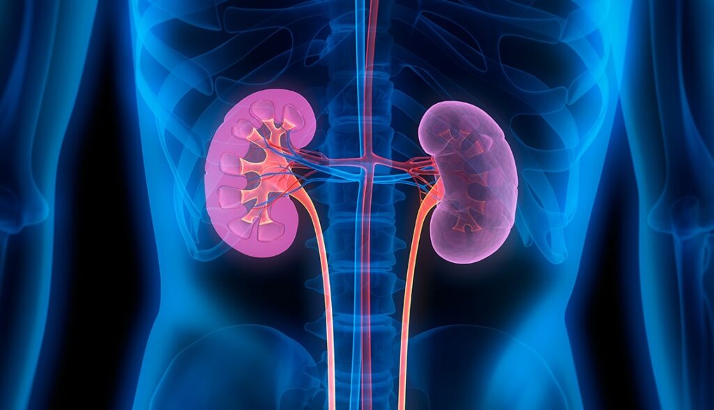 kidney diseases