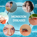 Keep Yourself Protected from Monsoon-Related Diseases