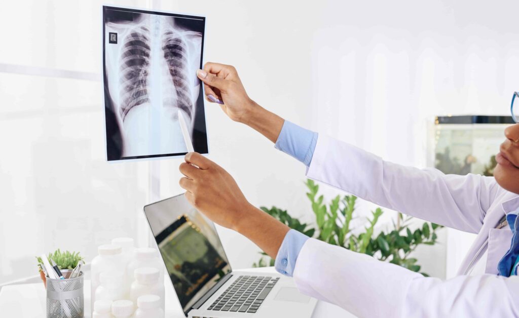 Lung cancer Sukino