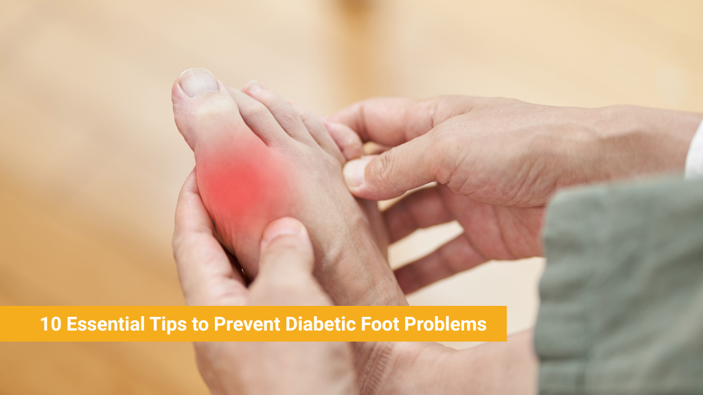 10 Essential Tips to Prevent Diabetic Foot Problems